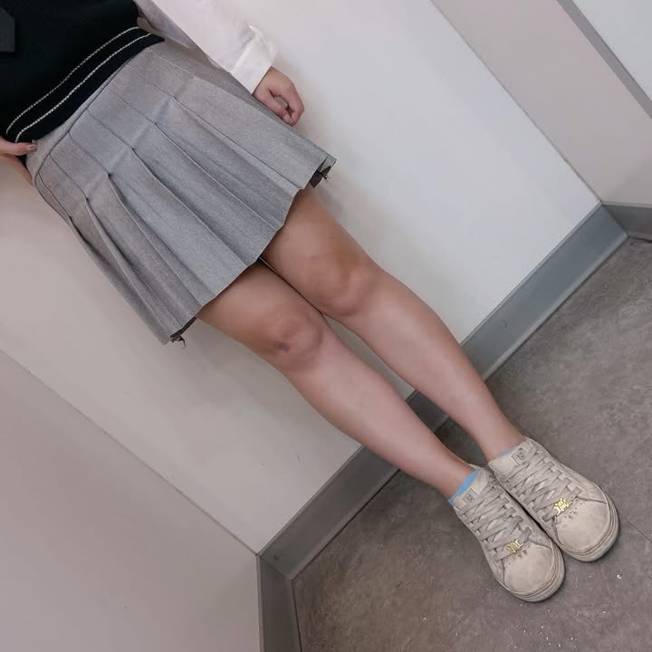 短版百褶裙:圖片 4