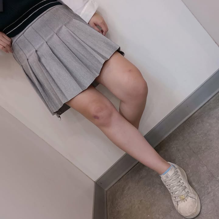 短版百褶裙:圖片 3